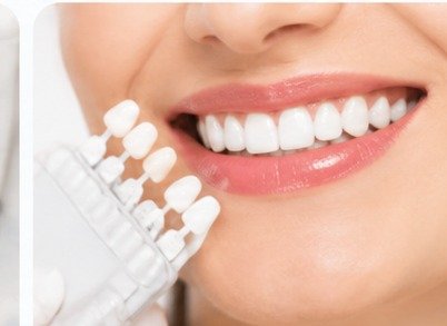 Smile and cosmetic dental shade guide