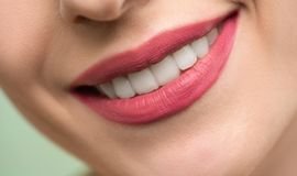 Smile Makeover